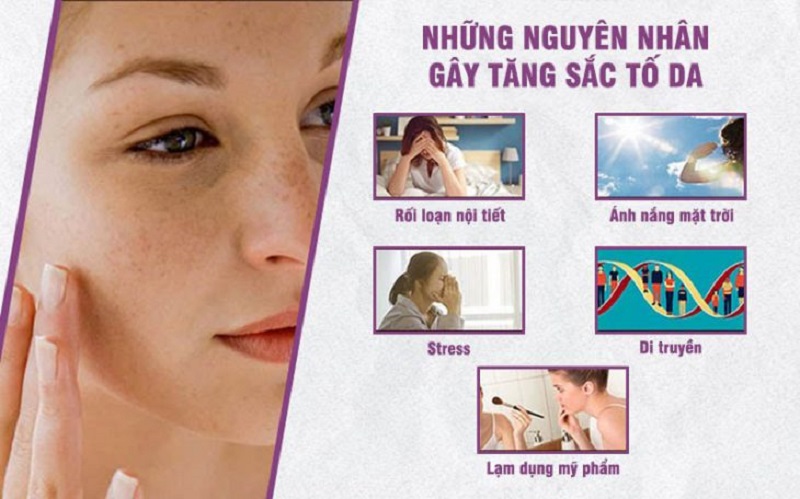 nguyên nhân gây tăng sắc tố da