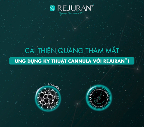 ????????????????????????????® ???? | CẢI THIỆN QUẦNG THÂM, NẾP NHĂN VÀ GIẢM SƯNG VÙNG MẮT BẰNG KỸ THUẬT CANNULA